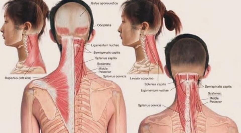 Diagram of neck muscles highlighting tension points treated at Annie Thai Massage, Egham, England, GB.
