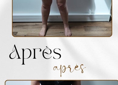 Résultat avant-après d'un soin chez Les femmes d'abord, Paris, Île-de-France, FR.