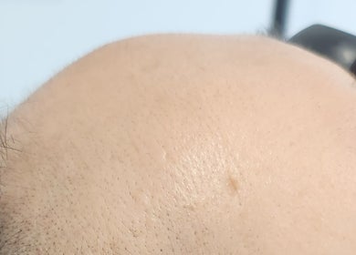 Close-up of a scalp showcasing treatment results at Maison Formé, Morley, Western Australia, AU.