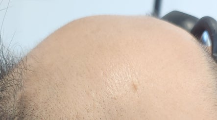 Close-up of a scalp showcasing treatment results at Maison Formé, Morley, Western Australia, AU.