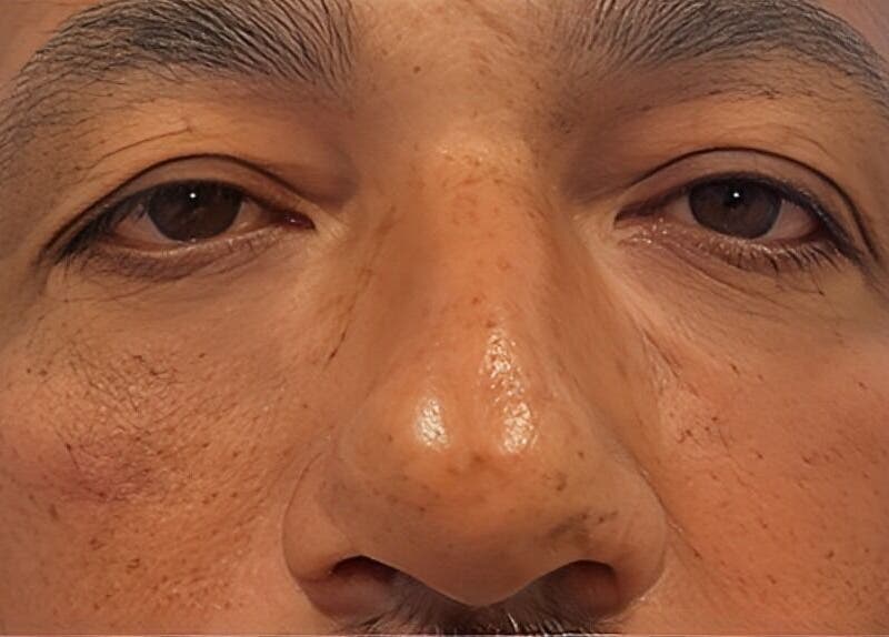 Close-up of a rejuvenated face at LS Medical Spa and Institute, Orlando, Florida, US.