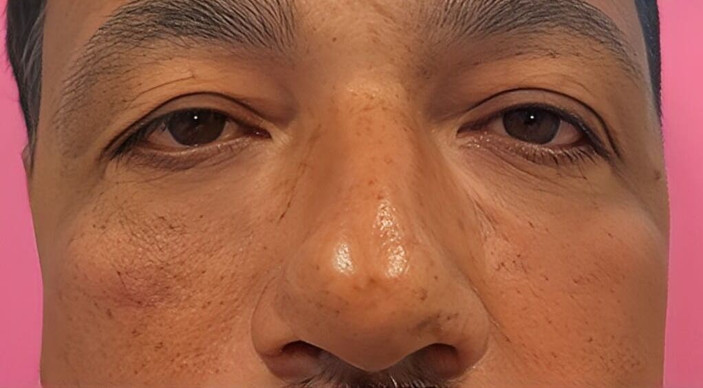 Close-up of a rejuvenated face at LS Medical Spa and Institute, Orlando, Florida, US.