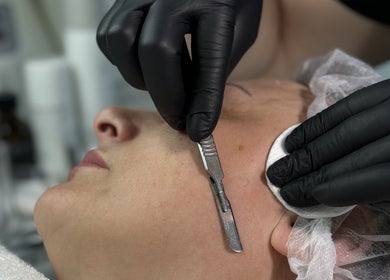 Dermaplaning treatment at Sweet Epil Beauty in London, England, GB offering expert skincare solutions.