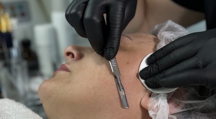 Dermaplaning treatment at Sweet Epil Beauty in London, England, GB offering expert skincare solutions.