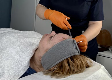 Aesthetic procedure at Sweet Epil Beauty in London, England, GB highlighting expert skincare.