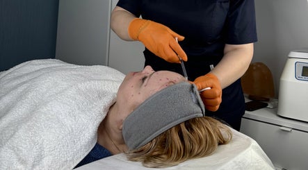 Aesthetic procedure at Sweet Epil Beauty in London, England, GB highlighting expert skincare.