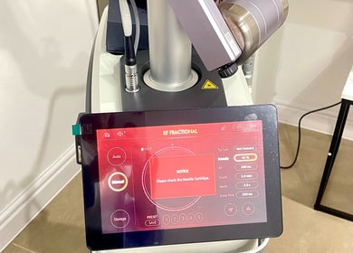 Advanced RF machine at NovaLx Aesthetics Clinic, Brierley Hill, England, GB for top-tier skin treatments.