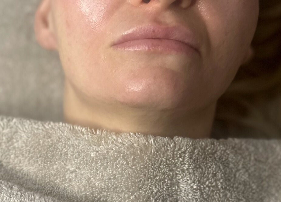 Close-up of a woman's glowing skin after a facial at SkinSoNü in Prestwich, England, GB.