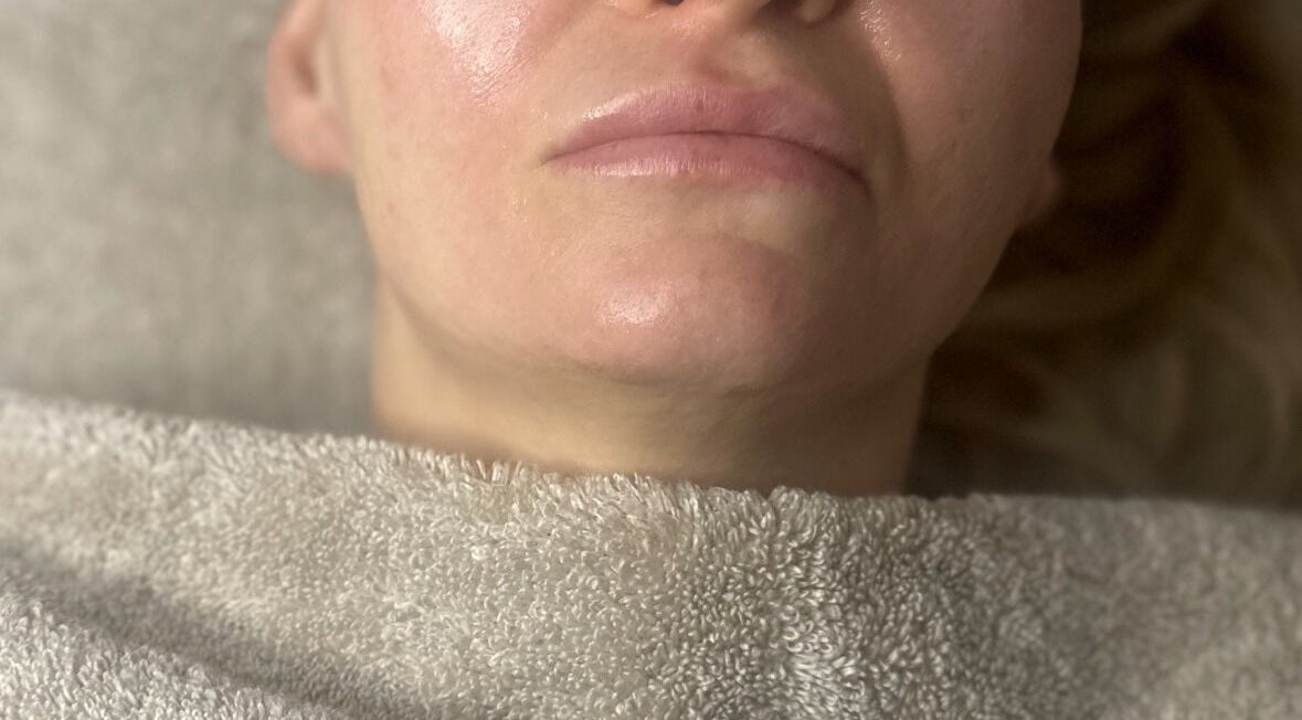 Close-up of a woman's glowing skin after a facial at SkinSoNü in Prestwich, England, GB.
