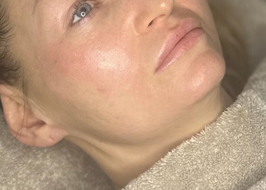 Woman receiving facial treatment at SkinSoNü, Prestwich, England, GB, showcasing smooth, glowing skin.