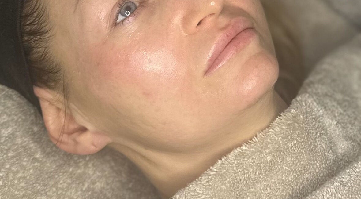 Woman receiving facial treatment at SkinSoNü, Prestwich, England, GB, showcasing smooth, glowing skin.