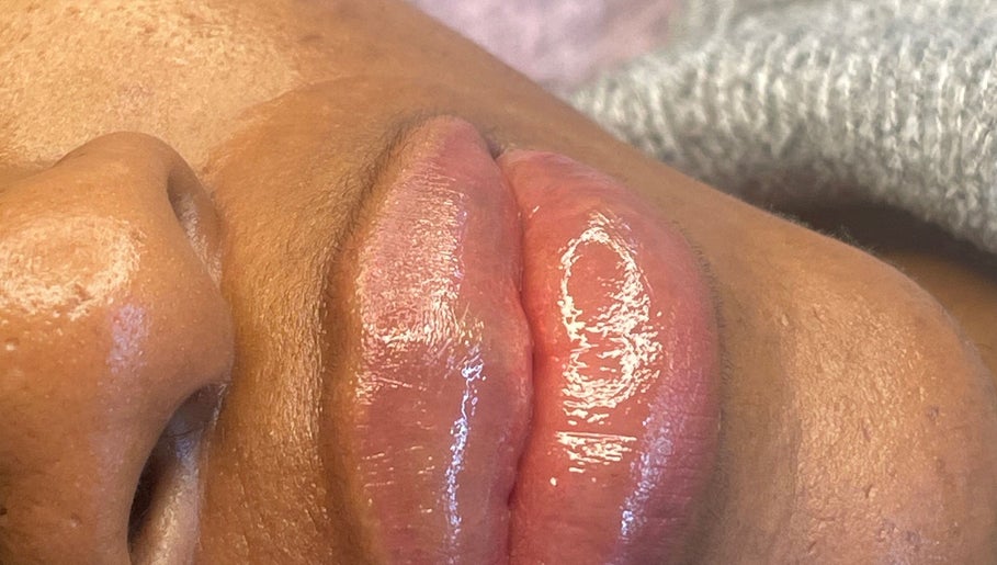 Glossy, enhanced lips treatment at Farnaz Beauty, London, England, GB, showcasing a radiant effect.
