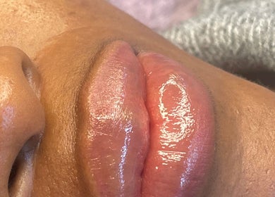 Glossy, enhanced lips treatment at Farnaz Beauty, London, England, GB, showcasing a radiant effect.