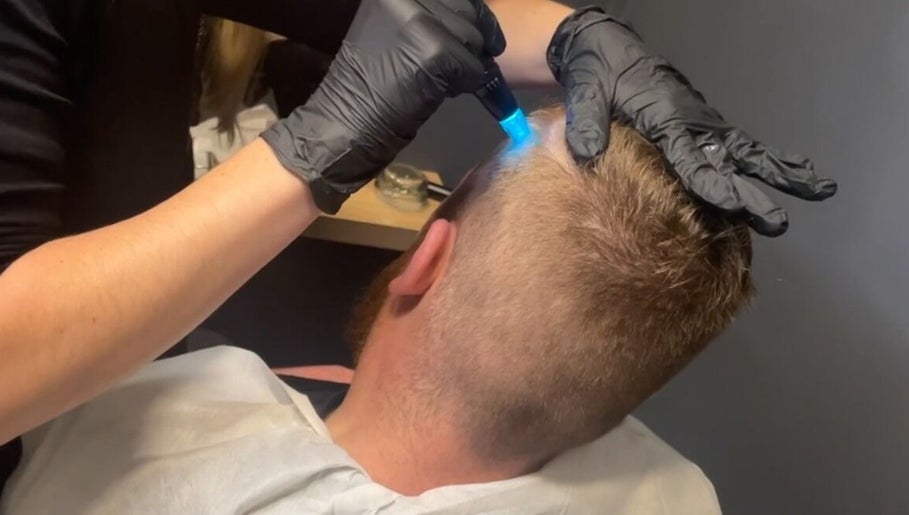 Hair loss treatment at Be-You Hair Loss Specialist in Co Dublin, County Dublin, IE.