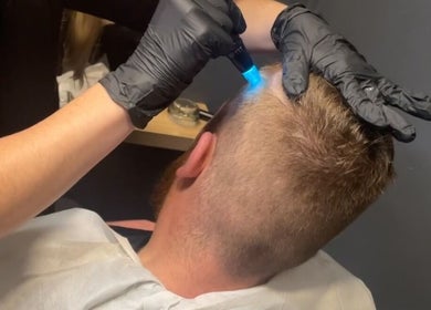 Hair loss treatment at Be-You Hair Loss Specialist in Co Dublin, County Dublin, IE.