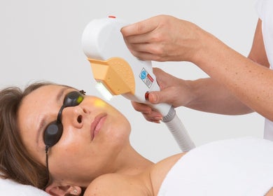 Traitement visage IPL à In Dermo, Milhaud, Occitanie, FR pour un teint radieux.