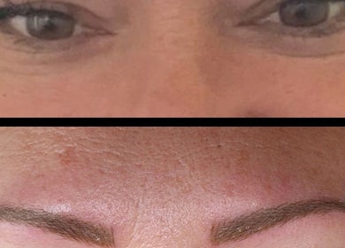 Transformation des sourcils avant-après chez In Dermo à Milhaud, Occitanie, FR, mettant en valeur un regard sublime.