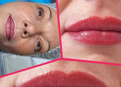 Résultat maquillage permanent des lèvres chez In Dermo, Milhaud, Occitanie, FR.