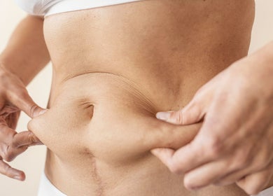 Détail du soin de la peau à In Dermo, Milhaud, Occitanie, FR, axé sur le bien-être abdominal.