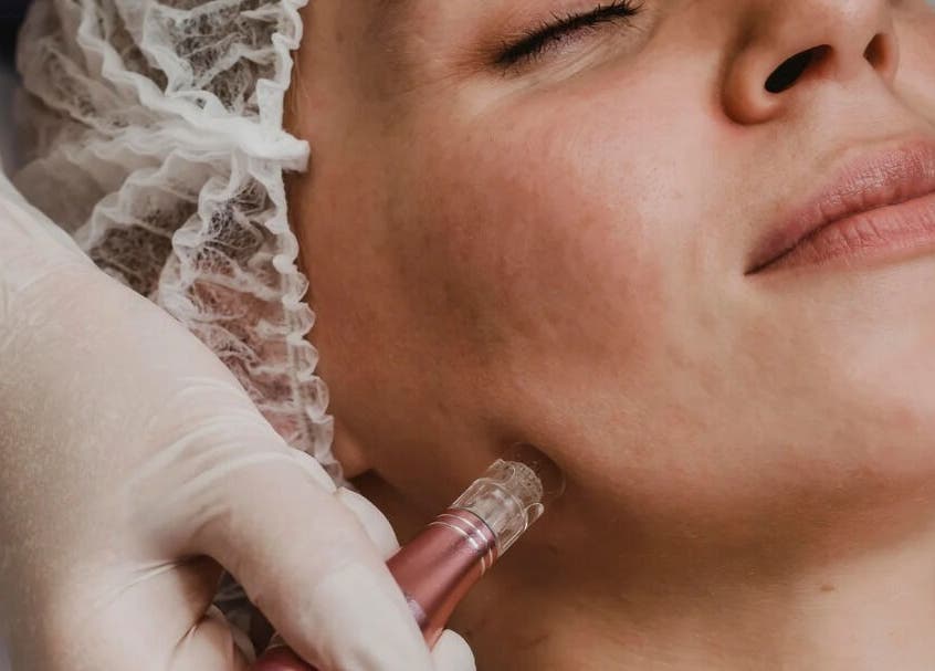 Facial treatment at Hina's Beauty Work Ltd, Auckland, Auckland, NZ, showcasing a microdermabrasion session.