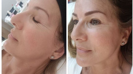 VBtupielensumejorversion