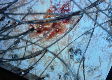 Detailed scalp analysis at Terapeutacapilar_joseanegomes in Pétange, Esch-sur-alzette, LU reveals hair health.