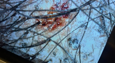 Detailed scalp analysis at Terapeutacapilar_joseanegomes in Pétange, Esch-sur-alzette, LU reveals hair health.