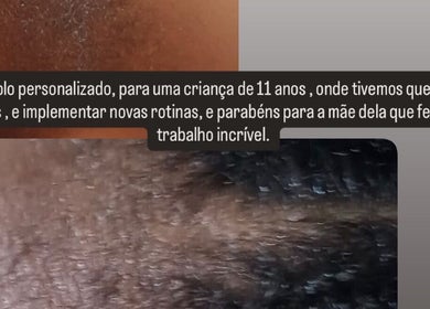 Custom treatment for 11-year-old at Terapeutacapilar_joseanegomes, Pétange, Esch-sur-alzette, LU.