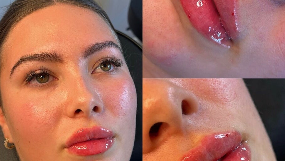 Close-up of flawless skin and glossy lips at Aura Aesthetics, Leeds, England, GB.