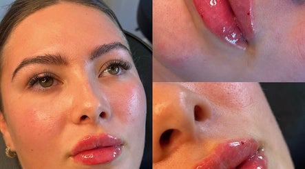 Close-up of flawless skin and glossy lips at Aura Aesthetics, Leeds, England, GB.
