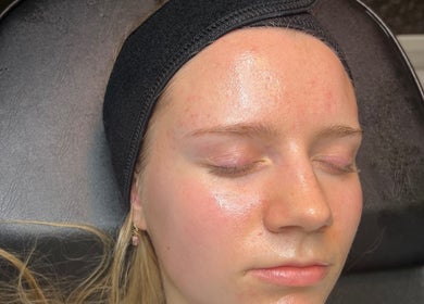 Client enjoying a facial treatment at Aura Aesthetics in Leeds, England, GB. Skin appears glowing and refreshed.