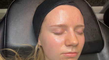 Relaxing facial treatment at Aura Aesthetics, Leeds, England, GB, enhancing natural glow and skin rejuvenation.