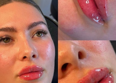 Close-up of radiant skin and glossy lips after treatment at Aura Aesthetics, Leeds, England, GB.