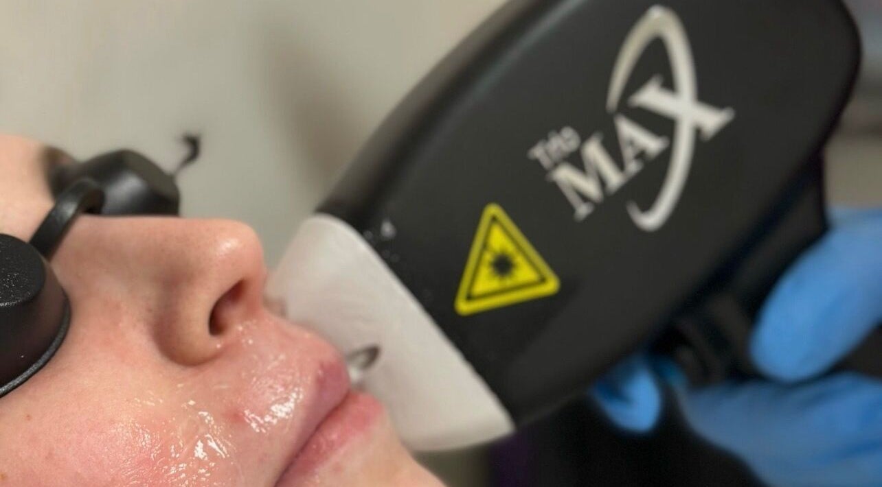 Terapie facială avansată la BodyCare by Mady, Dublin, County Dublin, IE.