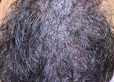 Close-up de cuir chevelu traité chez ELEGANTIA Maquillage Permanent, Le Cannet, Provence-alpes-côte D'azur, FR.