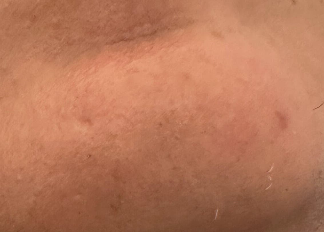 Tratamiento facial en Le’ Piel Clinic & Spa, Bayamón, Bayamón, PR, destacando piel saludable.