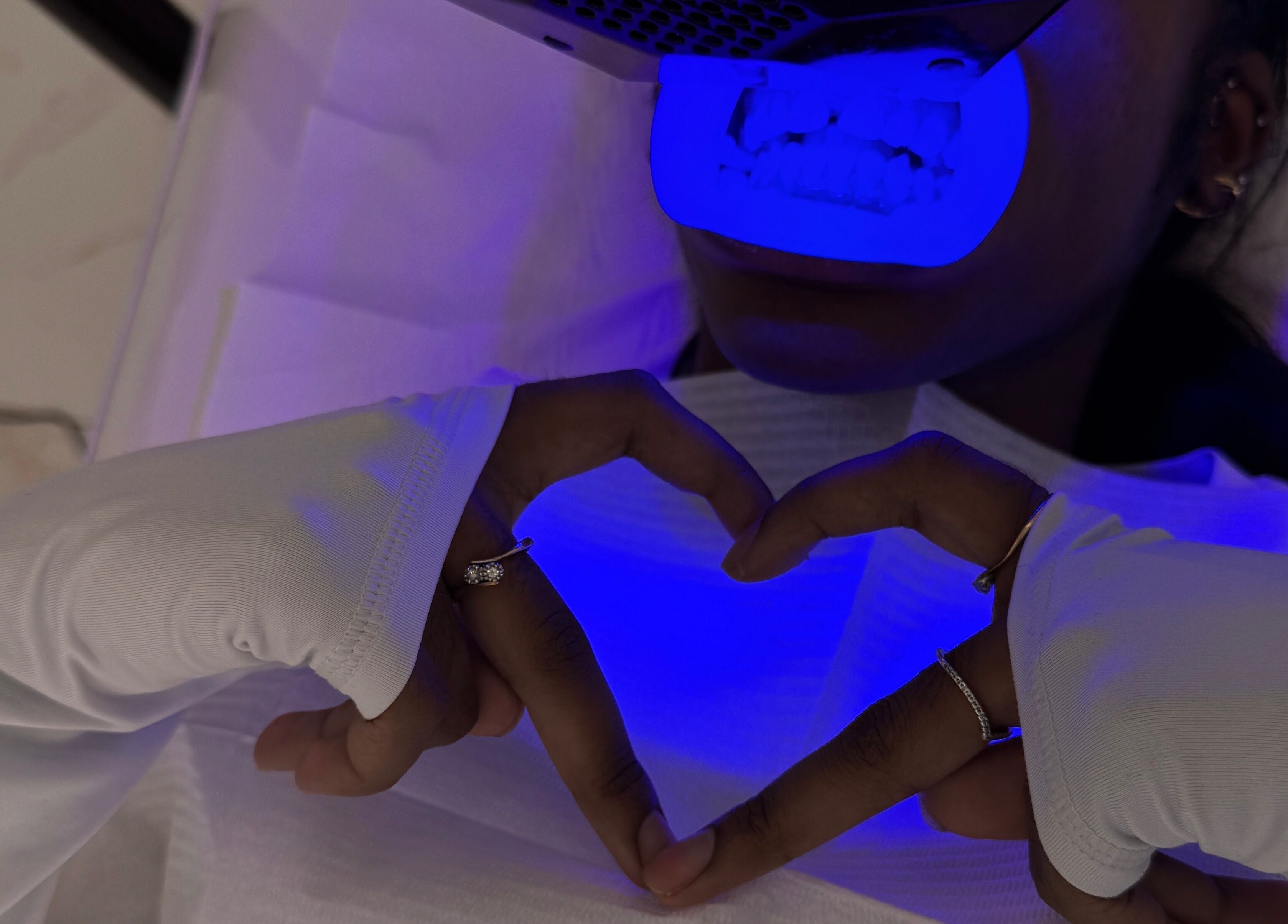 Teeth whitening session at Whitesbylia in London, England, GB, featuring a vibrant blue light treatment.