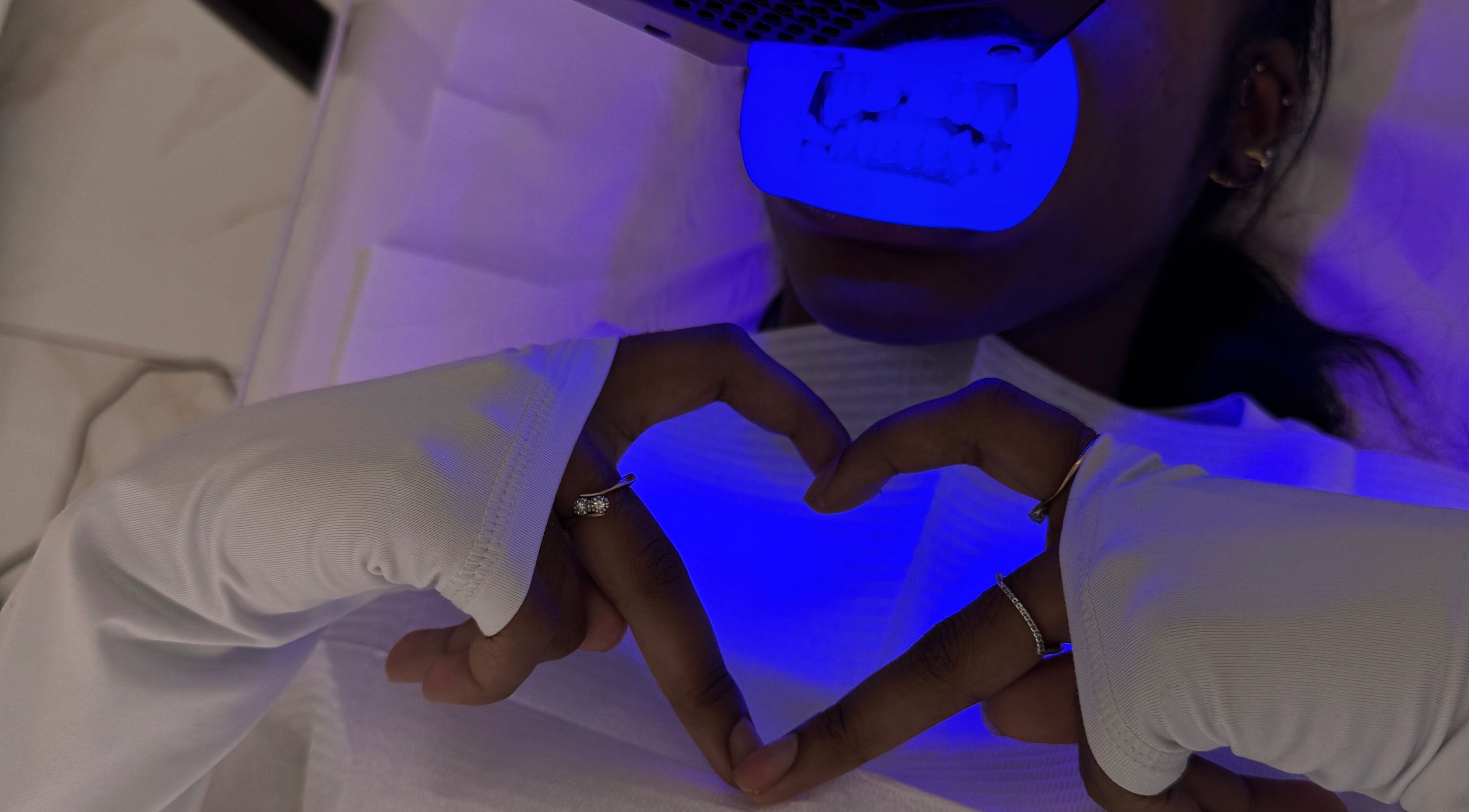 Teeth whitening session at Whitesbylia in London, England, GB, featuring a vibrant blue light treatment.