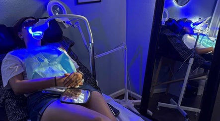 Teeth whitening session at Glow Up Aesthetics, Texas, Texas, US, highlighting advanced dental care.