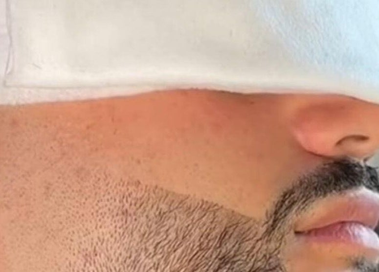 Facial treatment at Venuz&Zeus Spa in Burgas, Burgas, BG promoting relaxation and rejuvenation.