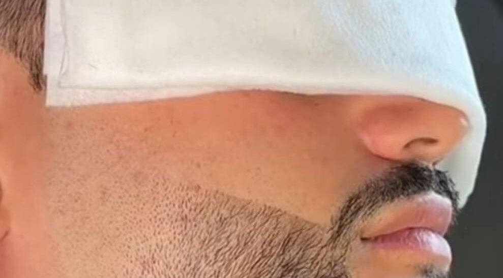 Facial treatment at Venuz&Zeus Spa in Burgas, Burgas, BG promoting relaxation and rejuvenation.