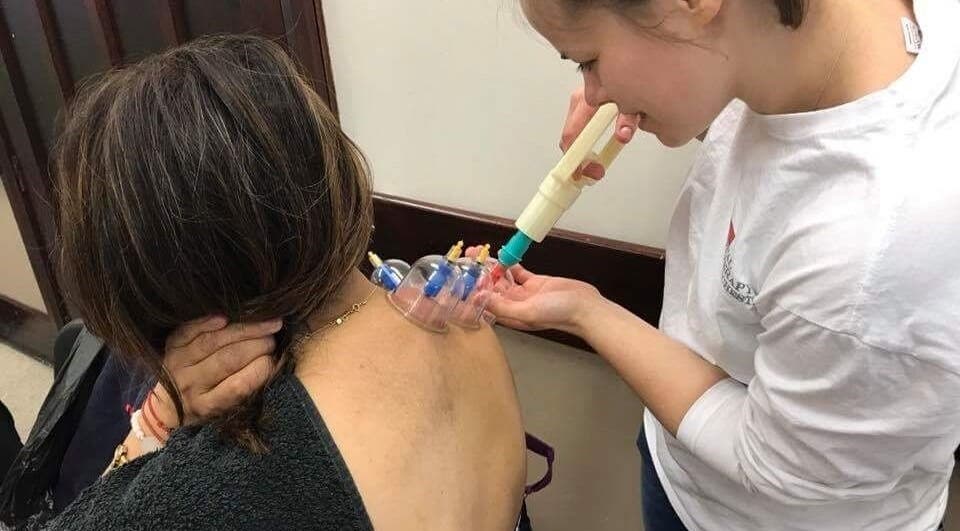 Cupping therapy session at Astbury Acutherapy in Congleton, England, GB, showcasing expert wellness care.