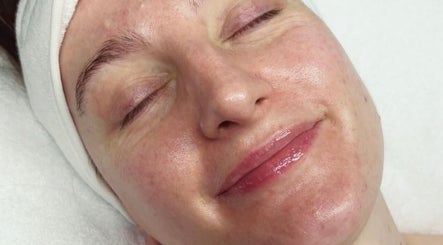 Close-up of a relaxed face with glowing skin at Opulence Skin Aesthetics, Whiston, England, GB.