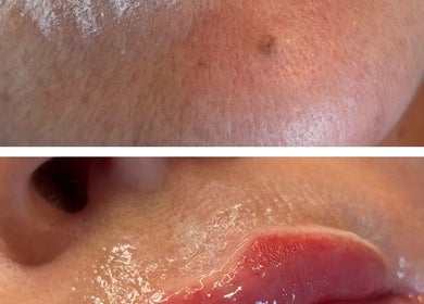Skin treatment result at LASH EM BEAUTY, AESTHETICS & PMU, Wallsend, England, GB, showing smooth, hydrated skin.