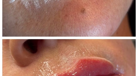 Skin treatment result at LASH EM BEAUTY, AESTHETICS & PMU, Wallsend, England, GB, showing smooth, hydrated skin.