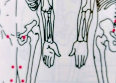 Illustration des points Hijama à Charmig Hijama & Relaxation, Ottawa, Ontario, CA.