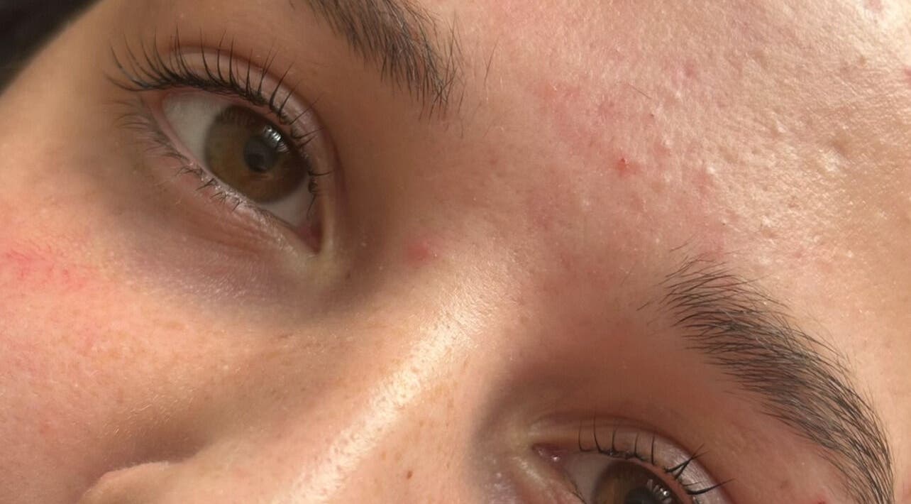 Close-up of a clear, glowing skin at The Beauty Vault in Tandragee, Northern Ireland, GB.