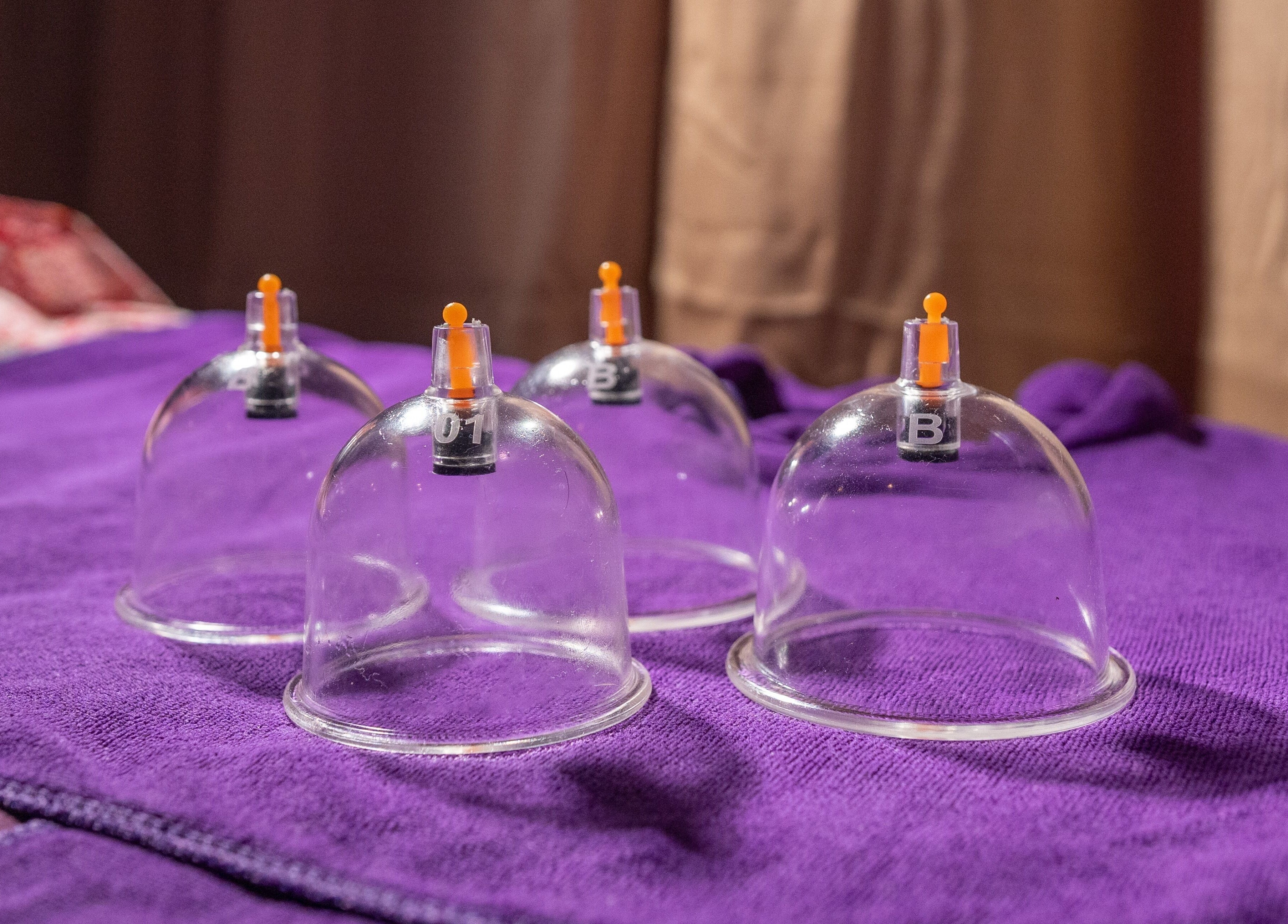 Cupping therapy equipment on a purple mat at Thai Time Wellness Spa, Singapore, Singapore, SG.