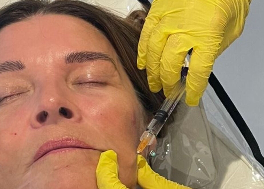 Facial treatment at LSC Beauty & Aesthetics in Cardiff, Wales, GB showcasing expert non-surgical aesthetic procedures.