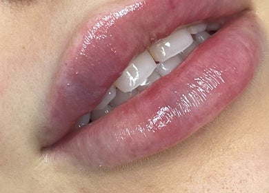 Close-up of glossy, hydrated lips at Shak Smith Aesthetics in Bridgetown, Saint Michael, BB.